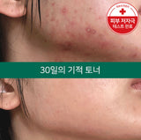 Some By Mi AHA-BHA-PHA Miracle Toner
