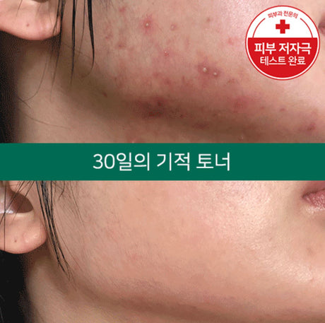 Some By Mi AHA-BHA-PHA Miracle Toner