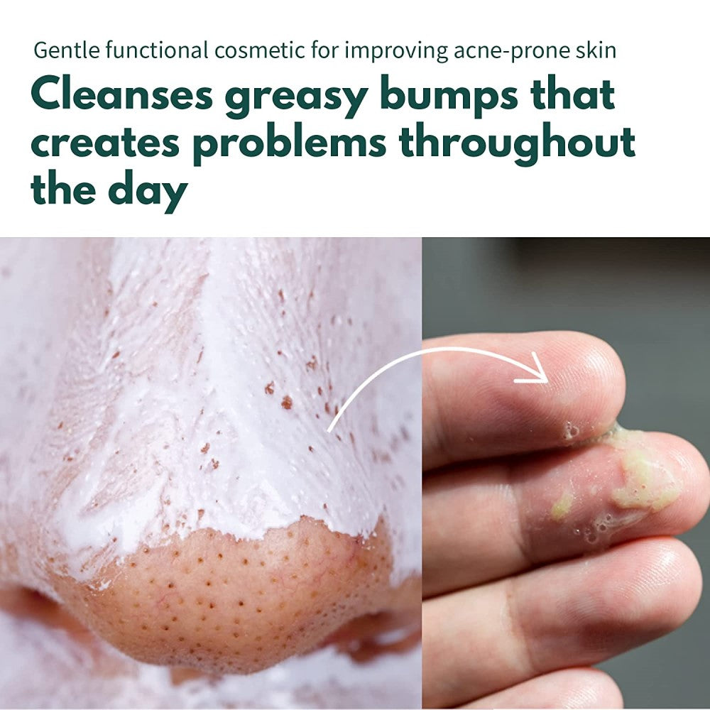*50% OFF* P.CALM UnderPore Foam Cleanser 5.07 fl.oz